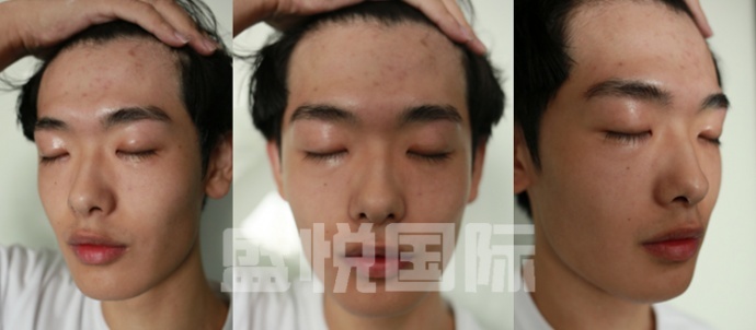 不(bù)疼的(de)“整容”秘籍！